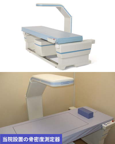 X線骨密度測定装置(HOLOGIC社製　Horizon Ci)